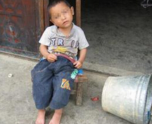 儿童癫痫具体的有哪些表现