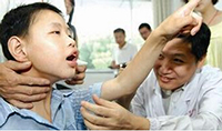 癫痫病遗传给下一代的几率大不大