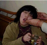 导致女性出现癫痫的原因有哪些
