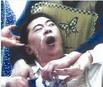 癫痫会不会遗传